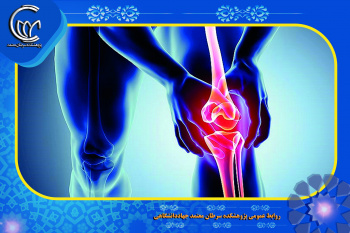 Researchers at the Motamed Cancer Research Center, ACECR, in collaboration with Tehran University of Medical Sciences (TUMS), have successfully developed an advanced treatment for knee arthritis using stem cells.